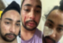 अंबाला में डंडे-बिंडो से युवक पर हमला: बदमाशों की धमकी-बोले, हम गैंगस्टर अमन सोनकर के बंदे; शिकायत सौंपी तो खत्म कर देंगे App Install Banner